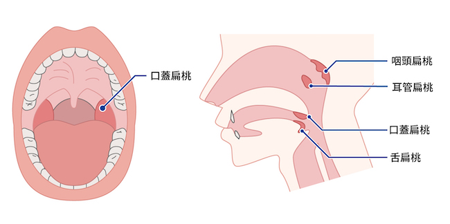 扁桃の病気／顔面・頭頸部の異常や聴覚・味覚・嗅覚・平衡感覚の異常